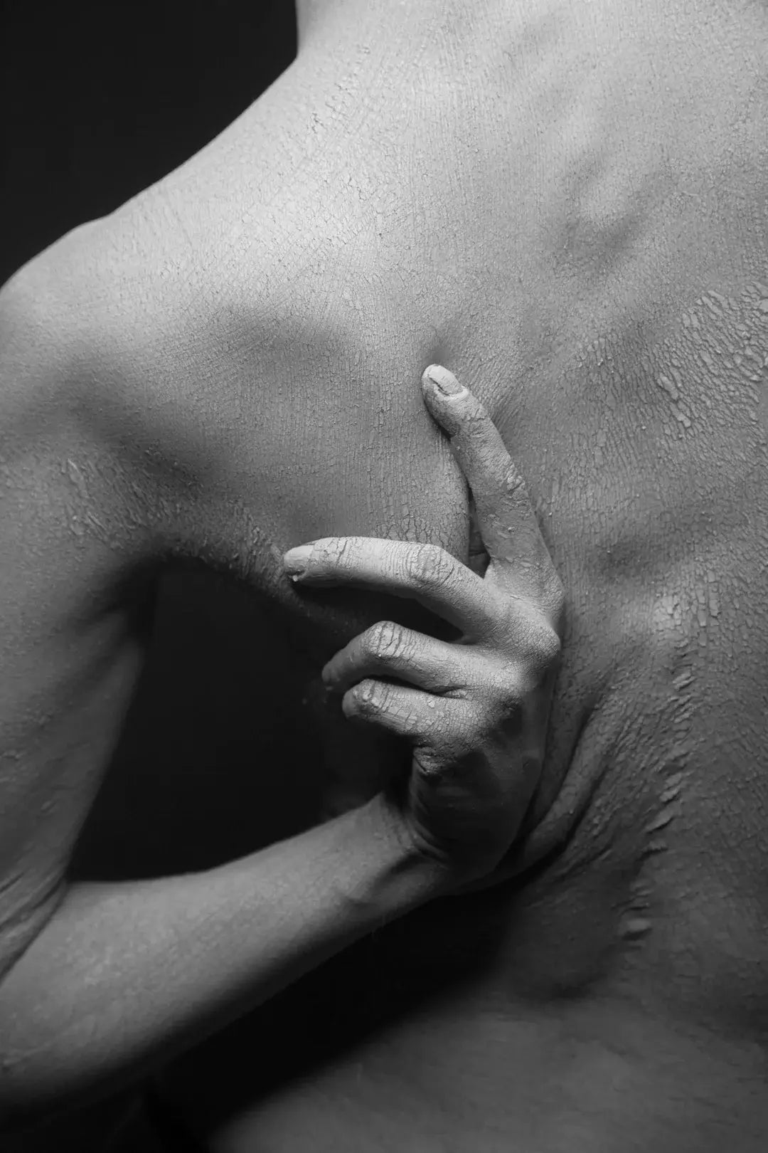 Women with eczema