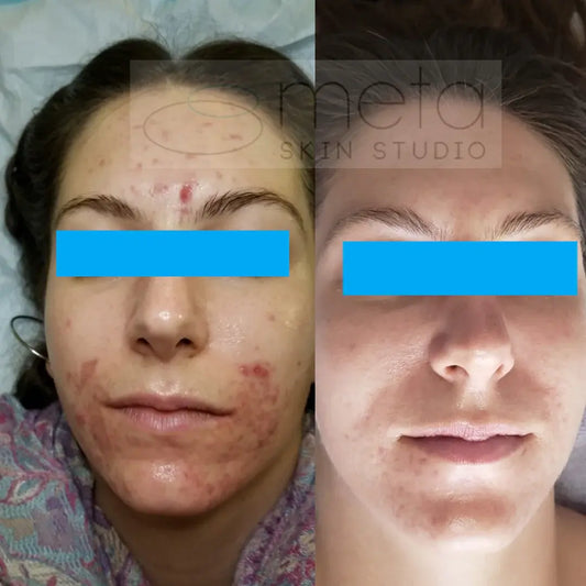 Amanda before and after with eyes covered