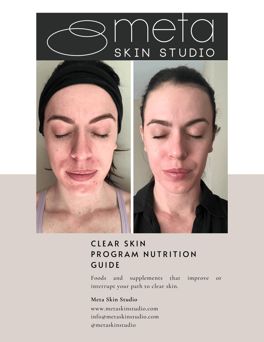 Meta Skin Studio