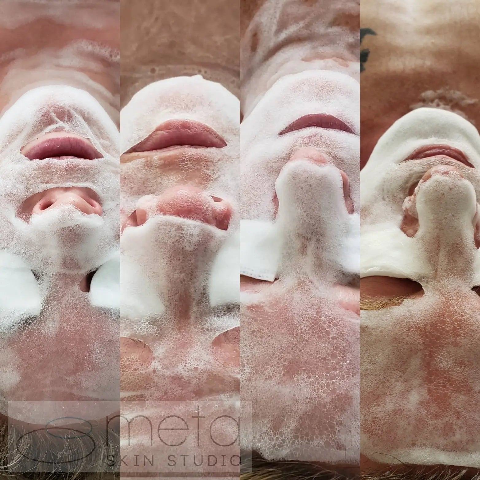 Women skin transformation facial - Meta Skin Studio